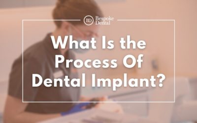 What Is The Process Of Dental Implant?