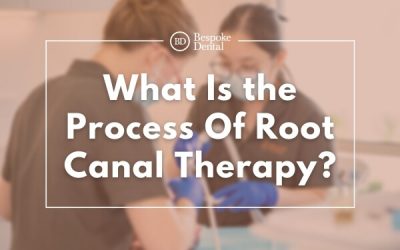 What Is the Process Of Root Canal Therapy?